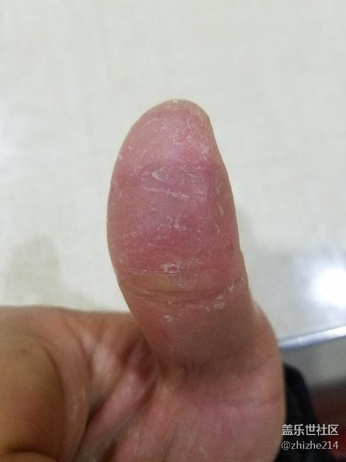 天残手怎么用指纹识别
