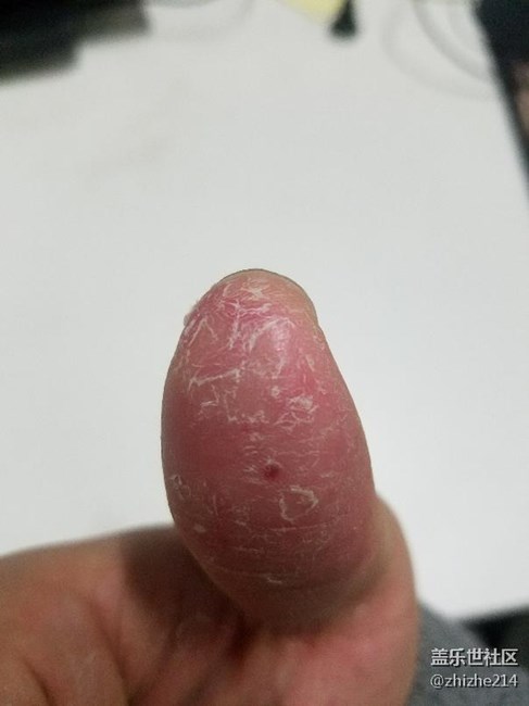 指纹坏了
